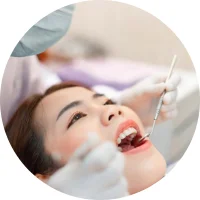 quy-trinh-veneer-1