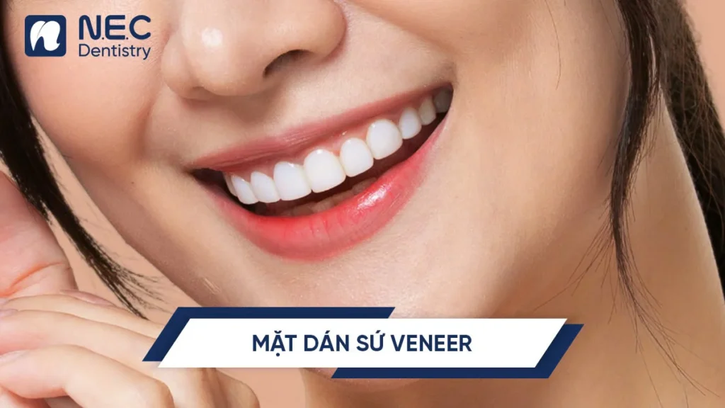 Dan-su-veneer-1