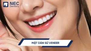 Dan-su-veneer-1