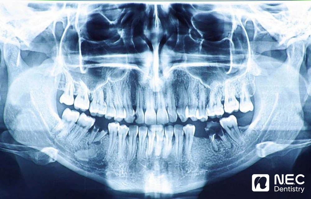 Dental-tourism-in-NEC-2