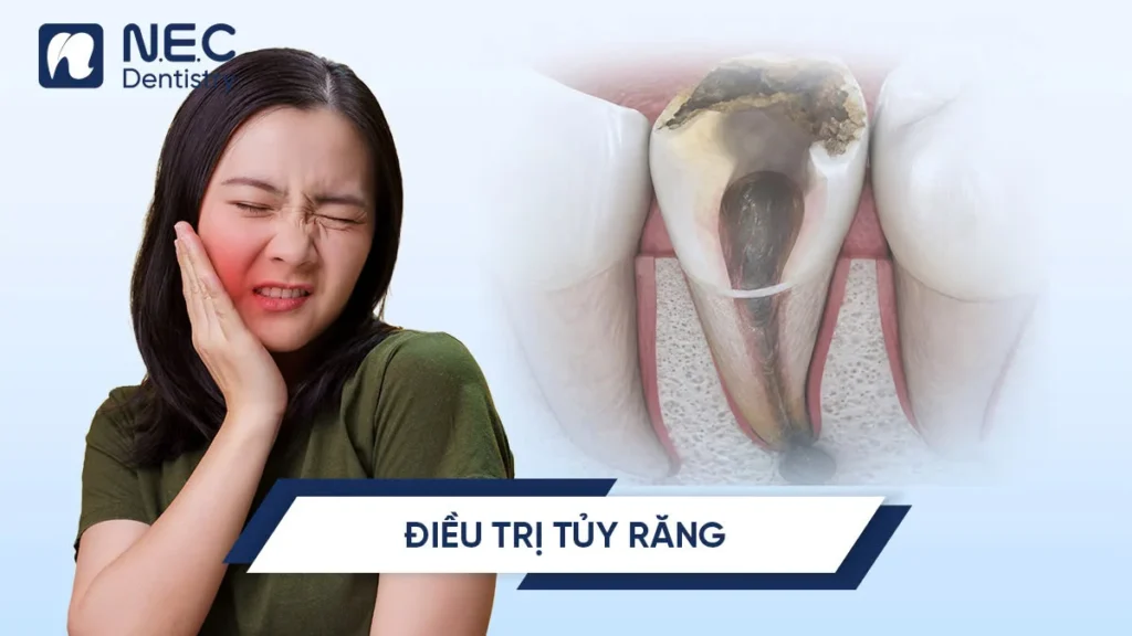 Dieu-tri-tuy-rang-0