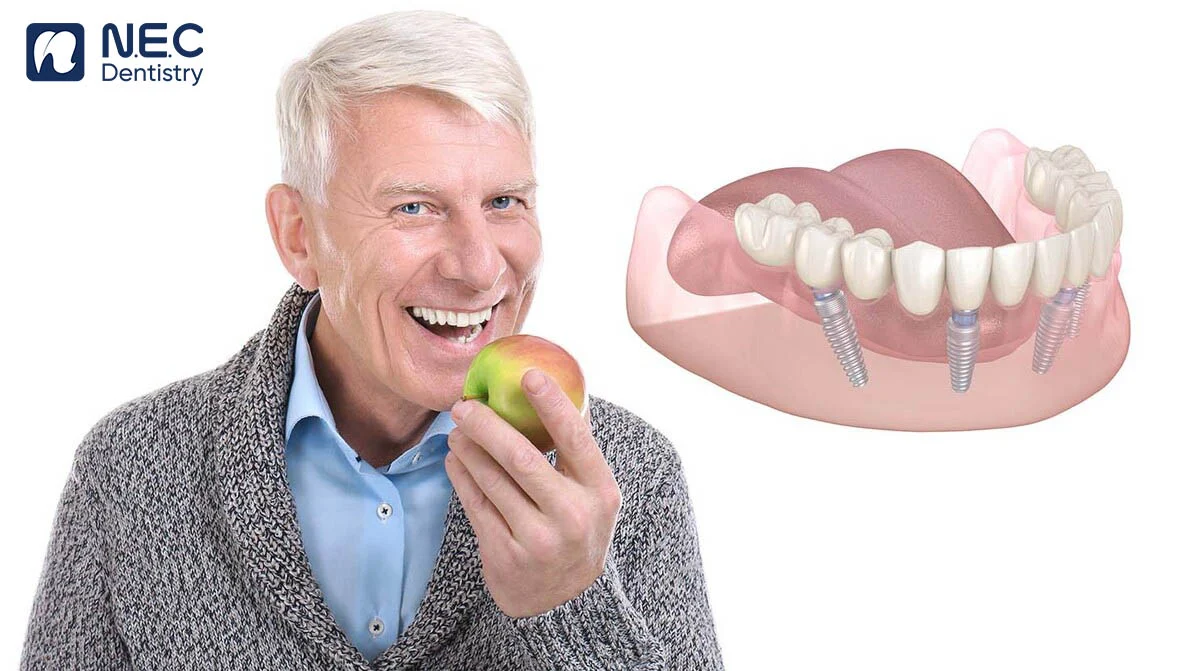 quy-trinh-cay-ghep-implant-6