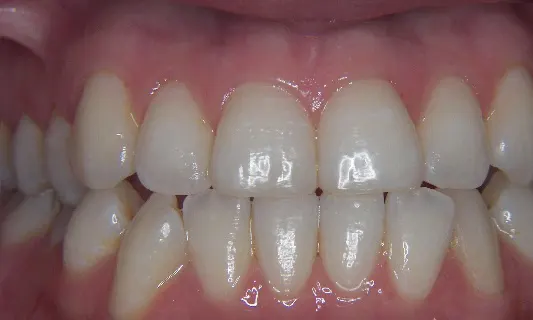 K-Huyen1 K-Huyen1