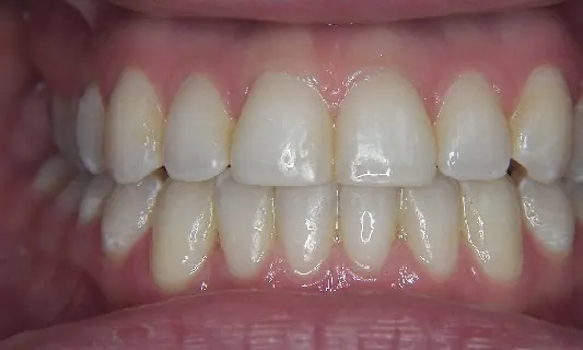 K-Huyen2